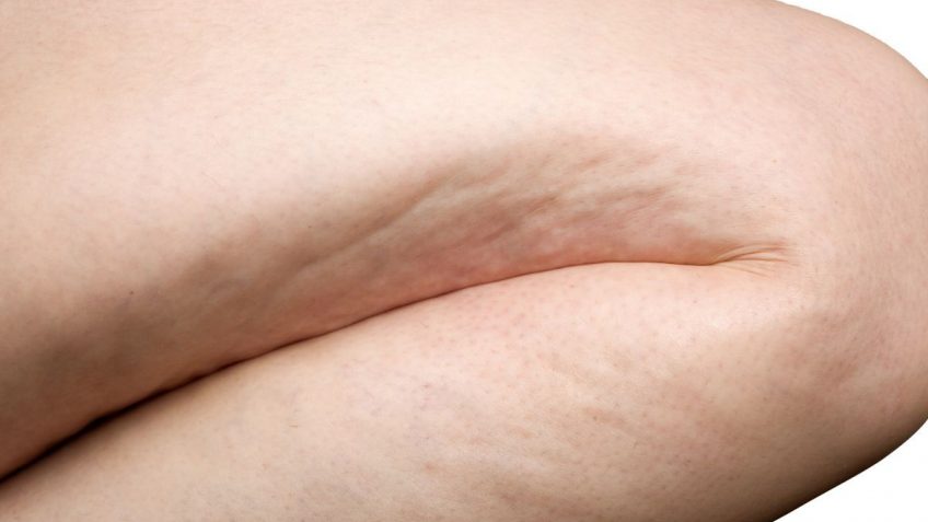 Nivea Body Goodbye cellulite gel-krema